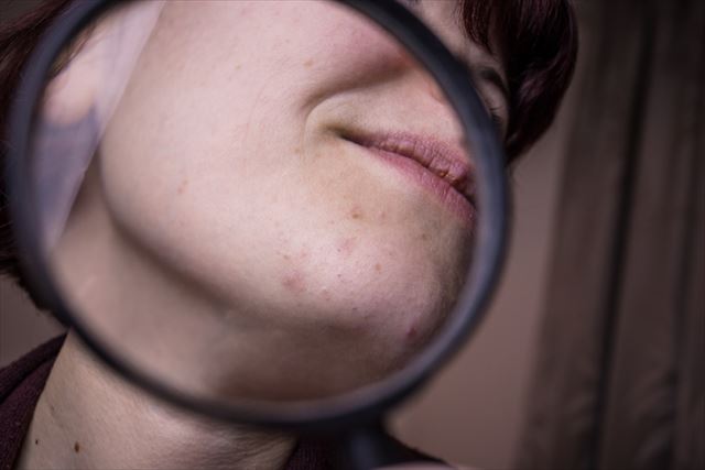 肌を近くで見ると汚い人はコレが原因 顔をキレイに導くポイントまとめ Odeco Mart Blog